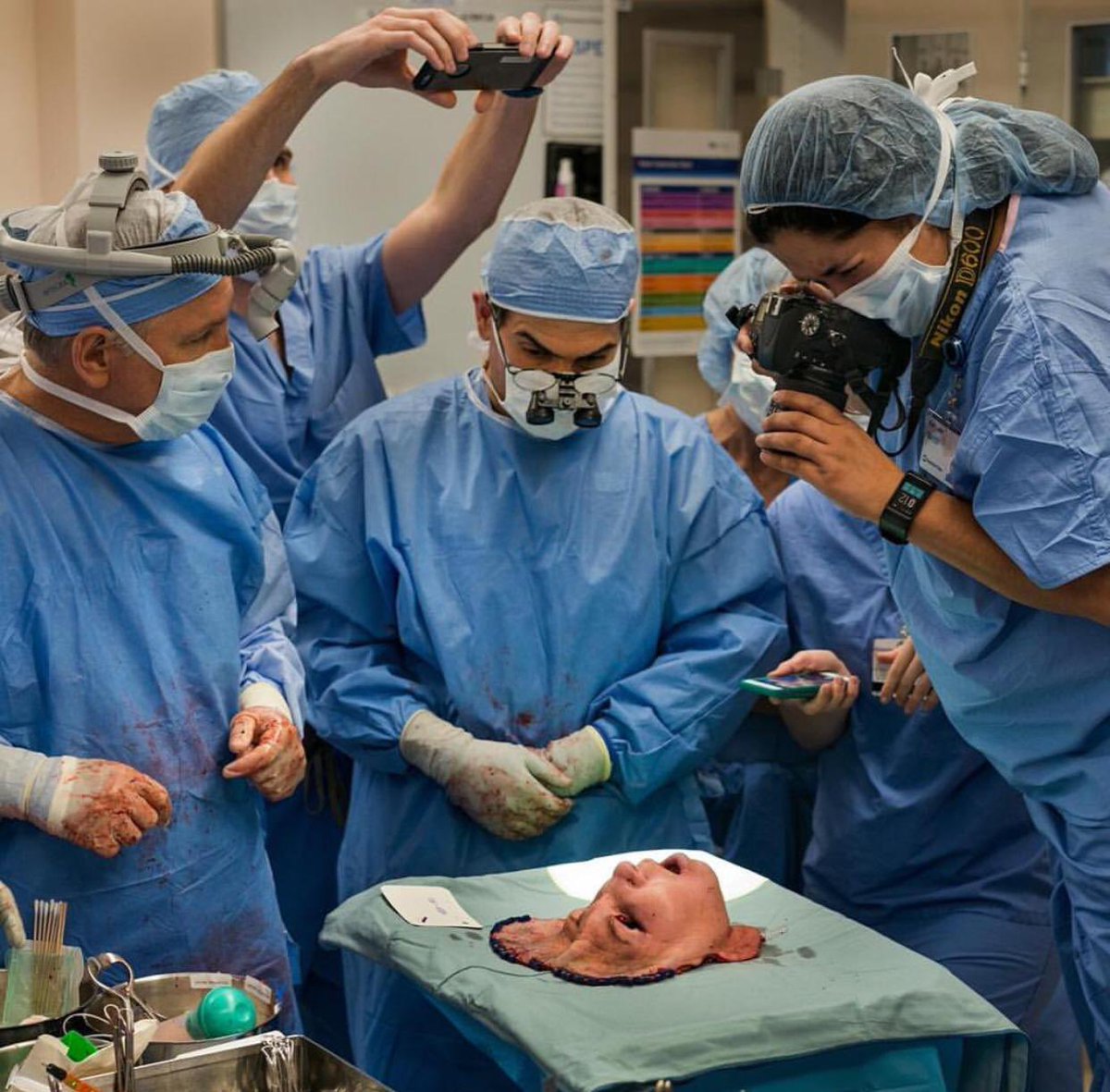 Human face transplant 🥸 Check video on thread 👇 Medicine is awesome 🔥👀