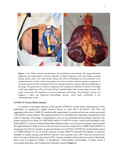 mRNAdeaths's tweet photo. " Because the autopsy ruled out other possible causes of death, prior COVID-19 vaccination is potentially either the direct cause or contributed to the causal pathway leading to death." https://t.co/SDwyLbI4Vd