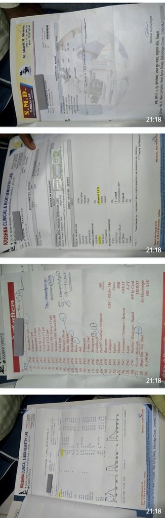 kausar_nargis's tweet photo. His wife suddenly collapsed due to high grade fever
Hospitalised nearby, diagnosed as severe infection, blood sugers are still uncontrolled even after 3 days treatment nd multiple problems.
Kindly #Donate
#Target_20k including catastrophic charges.
#RT https://t.co/yHHNzk6wnr