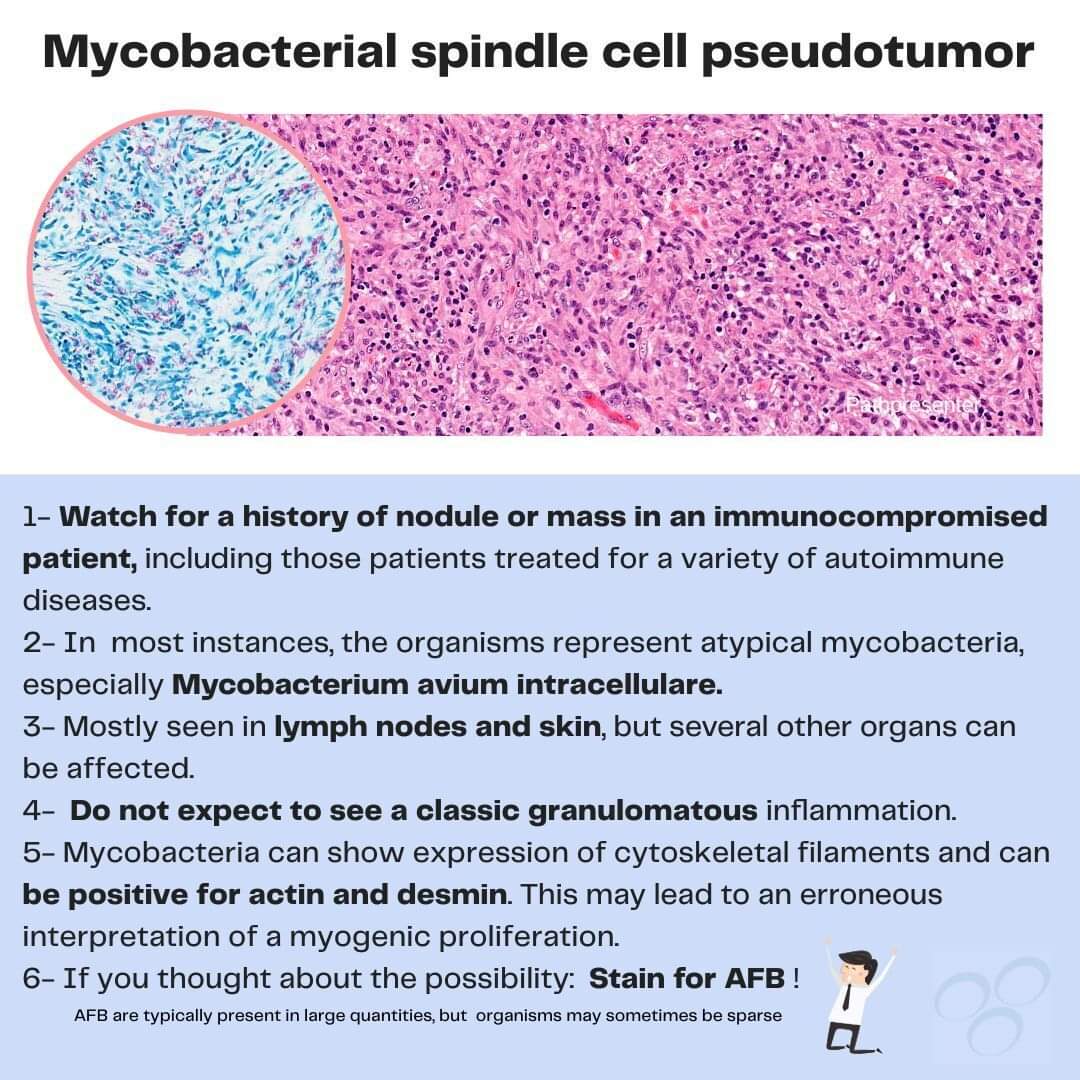 ✅An interesting case and logically accompanied by special TIPS! #entpath #pathology