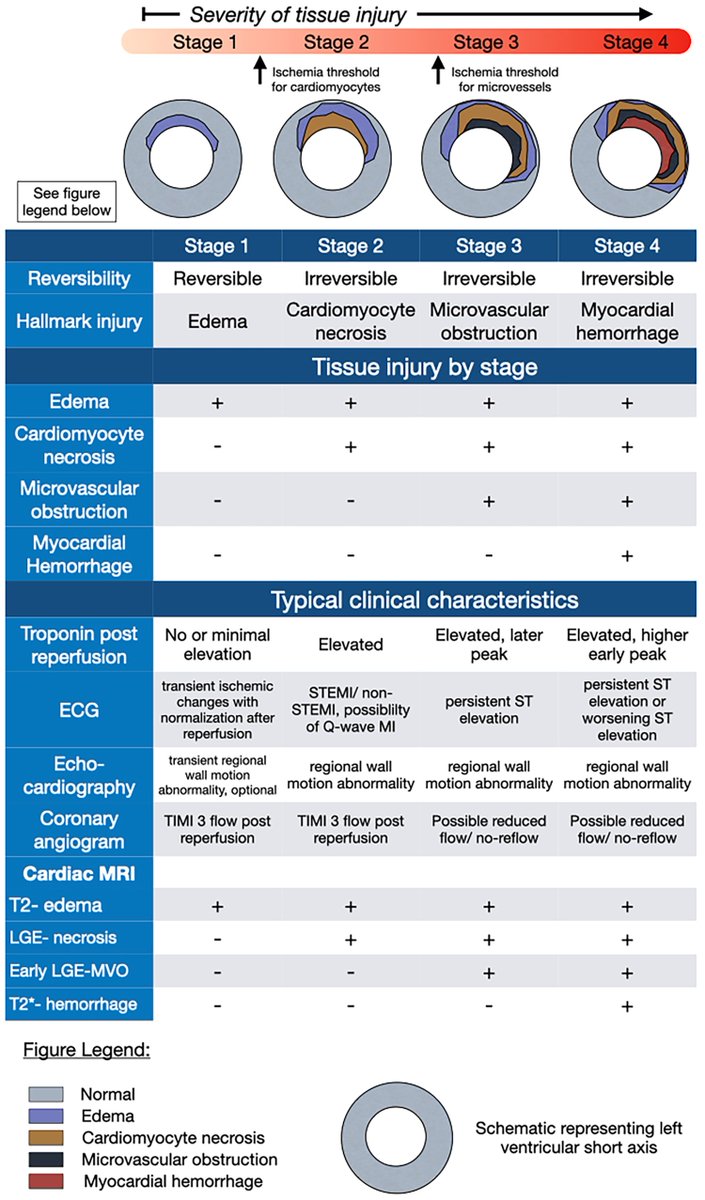 EHJ Editor-in-Chief (@ehj_ed) on Twitter photo Tissue changes in reperfused myocardial infarction: the 4 stages of myocardial ischaemia and reperfusion injury can be classified.
doi.org/10.1093/eurhea…
#MI #reperfusion #ischemia #cardiotwitter <a href="/ESC_Journals/">European Society of Cardiology Journals</a> <a href="/escardio/">European Society of Cardiology</a> Tissue changes in reperfused myocardial infarction: the 4 stages of myocardial ischaemia and reperfusion injury can be classified.
doi.org/10.1093/eurhea…
#MI #reperfusion #ischemia #cardiotwitter <a href="/ESC_Journals/">European Society of Cardiology Journals</a> <a href="/escardio/">European Society of Cardiology</a>