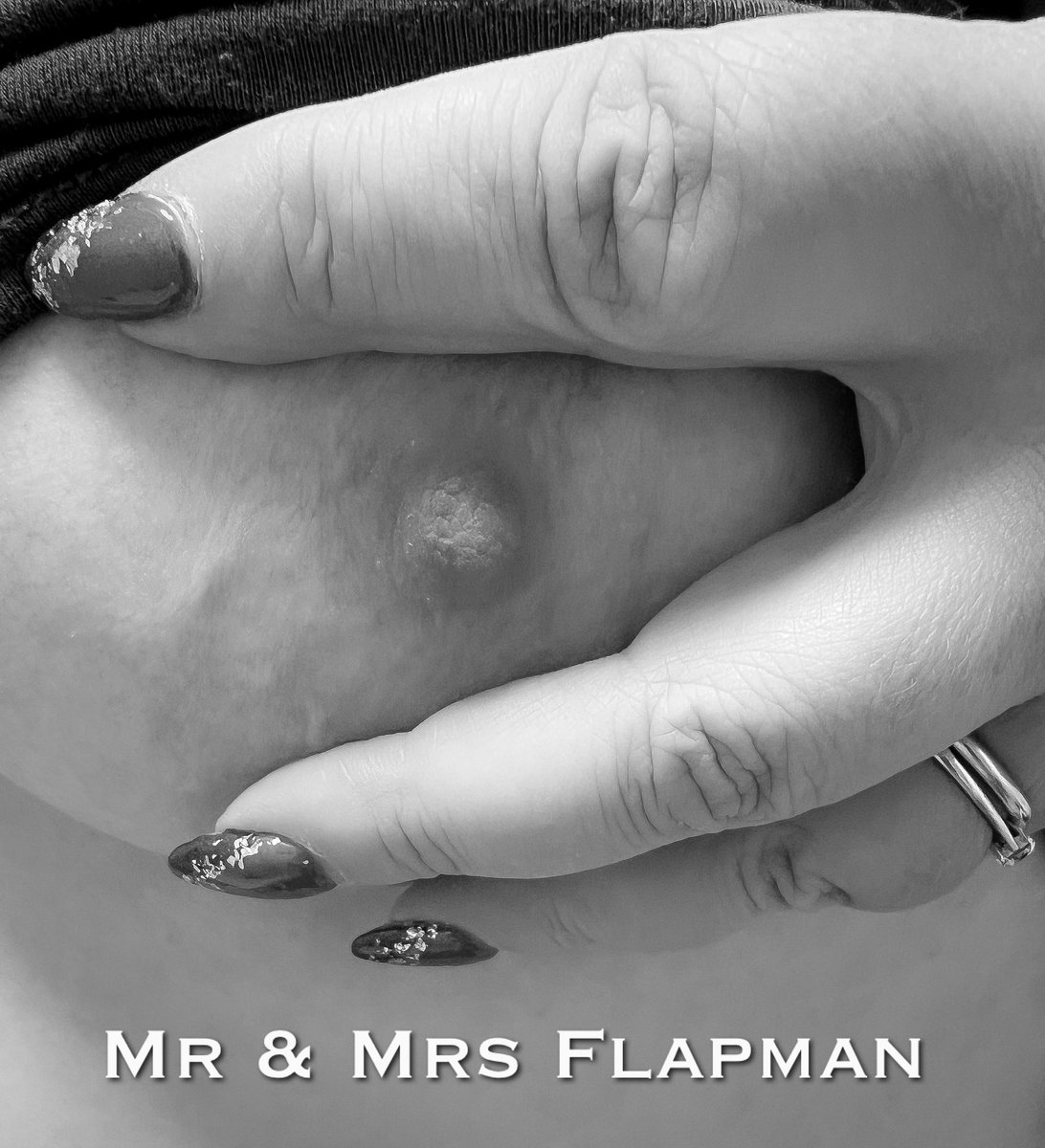 #OneBoobWednesday Oh no! Where did the other nipple go?❤️