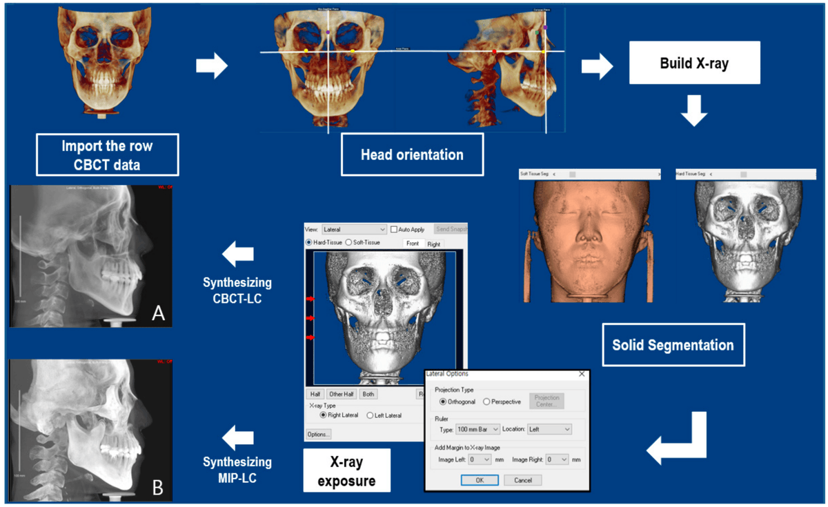 Sensors_MDPI's tweet photo. #highlycitedpaper
Automatic Cephalometric Landmark Identification System Based on the Multi-Stage Convolutional Neural Networks with CBCT Combination Images
https://t.co/RvKwPFaetq
#artificialintelligence #CNN #automaticidentification #lateralcephalograms https://t.co/OJpeaMFMc0