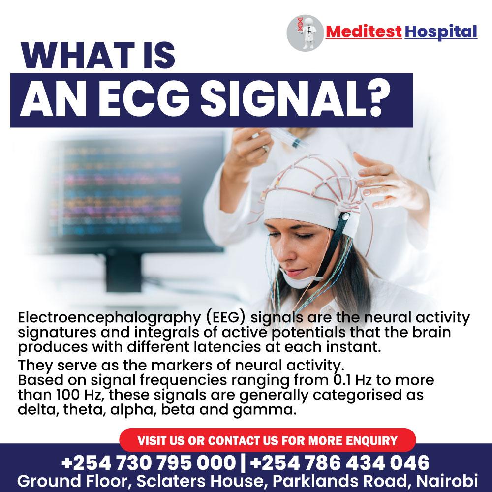 Meditest_Hsp's tweet photo. Unlocking the rhythm of life with mesmerizing ECG signals
Dive into the fascinating world of heart health and explore the intricate patterns that keep our hearts beating strong. #ECG #HeartHealth #141MPs #babuowino #jkia #kilimani #whatsapp #whotfdidimarry #DirectorTrevor #Nancy https://t.co/Gycvg6VJ4U