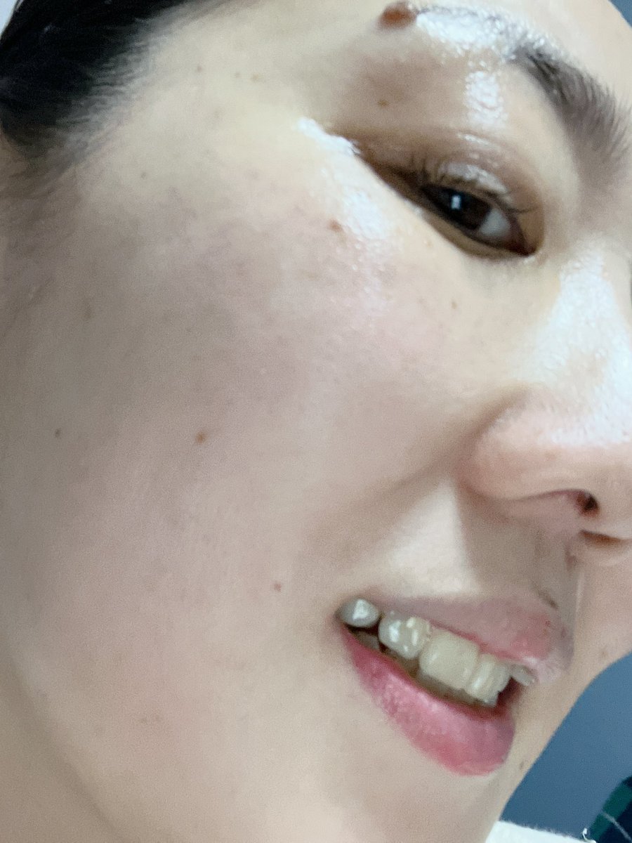 soratoumi0712's tweet photo. コエタスのモニターキャンペーンでもらった
くつろぎタイムのサプリメント
CBD JOY3 PLUS
についてレビュー
╰(*´︶`*)╯♡
ワンフォーオールサプリ
テアニンのパイオニア
#コエタス #PR
#cbdjoy3plus
#くつろぎタイム
#リラックス
#うつ病
#ストレス社会
#自律神経
#睡眠の質向上
@cbdjoy3_plus https://t.co/Qqtu4LJ3JT