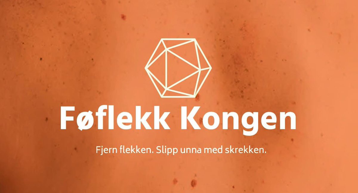 Viktig kunngjøring: Føflekk senteret skifter navn til Føflekk Kongen.

I flg. Kantor Paul Dingbats skal den nye profilen "1.signalisere oppdaterte verdier a la 2024 2. Begeistre, veilede og skape undring 3. Vekke tillitt hos den laverestående delen av befolkningen."