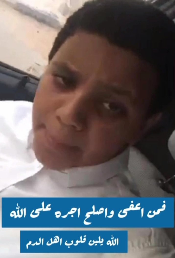 اسأل الله ان يعتق رقبته وأن يُليّن قلوب ذوي الدم للعفو والصفح ….

( فَمَنْ عَفَا وَأَصْلَحَ فَأَجْرُهُ عَلَى اللَّهِ )

 #عتق_رقبه_علي_الصيعري