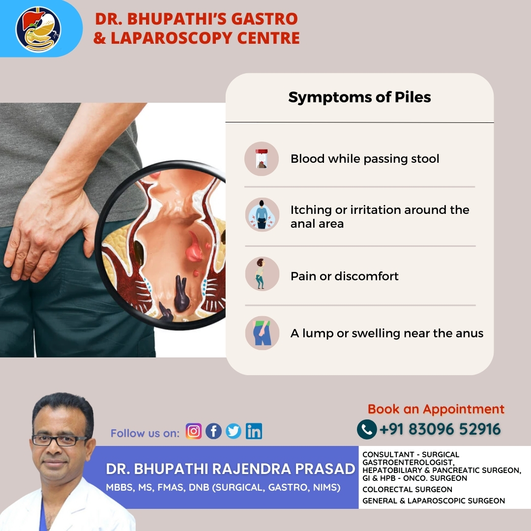 BhupathiRajend5's tweet image. Experiencing #discomfort, #bleeding, and #itching? It might be indicative of #hemorrhoids!

Lifestyle changes, dietary modifications, and over-the-counter medications may help #alleviate mild symptoms, but #severe cases may require proper #treatment.

☎️Call: +91 8309652916