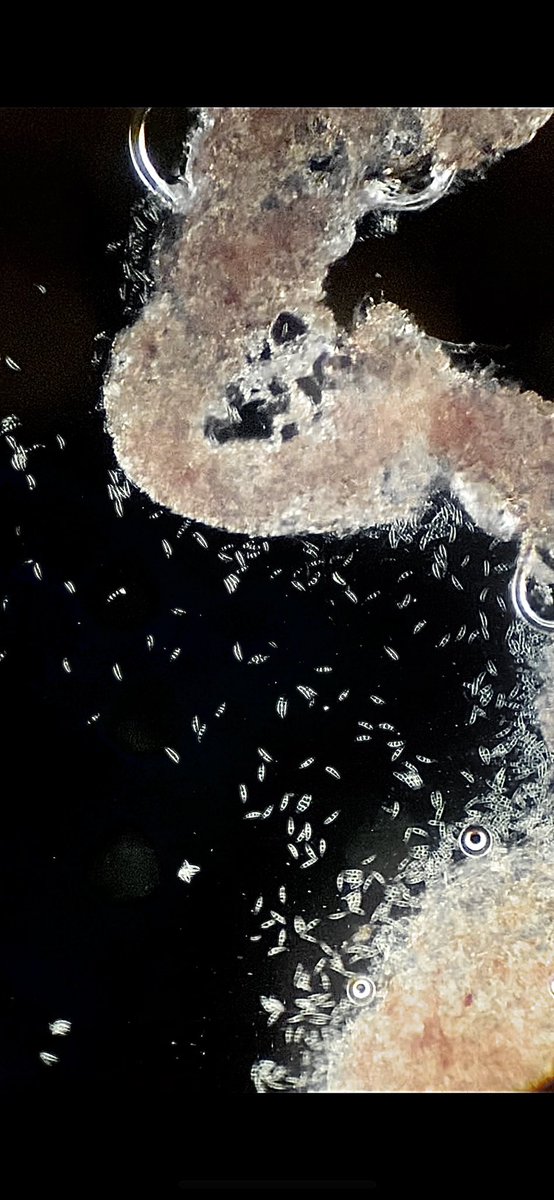 Taking a nosey are some fusarium culmorum under the microscope today! 
<a href="/mycotoxi/">Mycotox-I</a> <a href="/afbi_cross/">AFBI Crossnacreevy</a> <a href="/QUBelfast/">Queen's University Belfast 🎓</a>