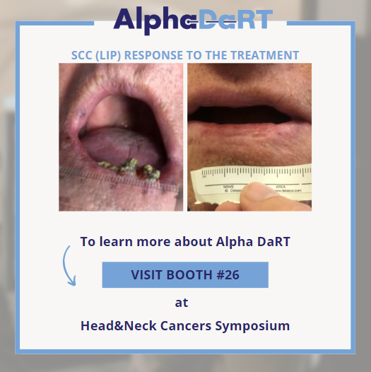 AlphaTauMedical's tweet photo. ‘24 Multidisciplinary #HeadandNeckCancers Symposium in Phoenix Visit Booth #26, Feb 29 - Mar 1 to explore #AlphaDaRT possibilities, live demo, and #ClinicalTrials. 

Schedule a meeting by emailing michaelt@alphatau.com. 

Feb. 29 or March 1. See you there! 👩‍⚕️👨‍⚕️ https://t.co/dN4XPlLnn6