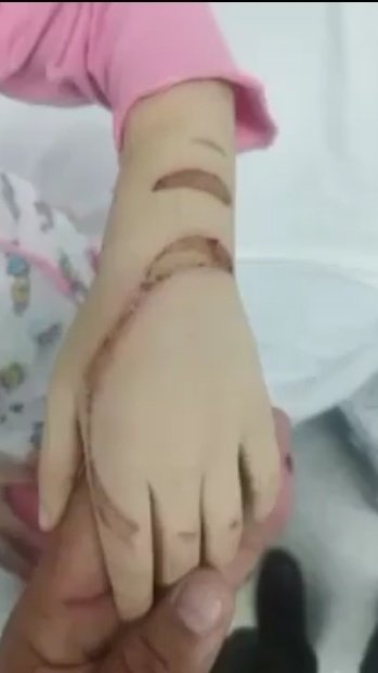 ColombiaOscura's tweet photo. #ABERRANTE. Dos niños eran sometidos a torturas por parte de sus padres en Sta. Rosa de Cabal (R/ralda). Cuando las autoridades llegaron al lugar gracias a la denuncia de vecinos, se encontraron con degarradoras escenas. 

⚠️ IMÁGENES SENSIBLES https://t.co/FBEI8UAAz4