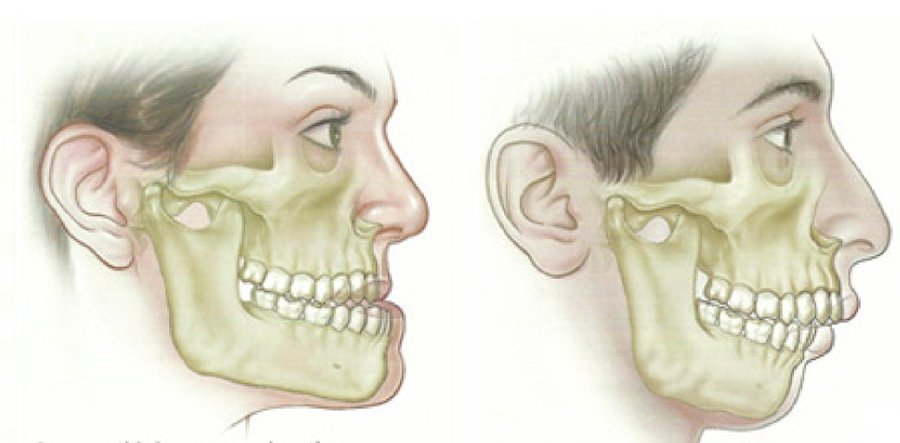 brettboettcher1's tweet photo. You breathe without thinking.

But 99% of people breathe incorrectly.

Here’s how to fix your breath for better physical performance, mental performance, and facial structure: https://t.co/8raGh3ubKC