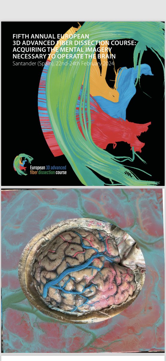 NeuroRaquisHUMV's tweet photo. We are looking forward to the start of the Fifth Annual European 3D Advanced Fiber Dissection Course!! 🧠 💪🏻 
@juanmartino2020 @carvelhn 
@HUnivValdecilla 
@unican @AforoCongresos 
@ZEISS_Group @MedtronicES @MBA_eu @GrupoPrim 
@SociedadSENEC 
#3DFiberSdr https://t.co/Okw1o7j566