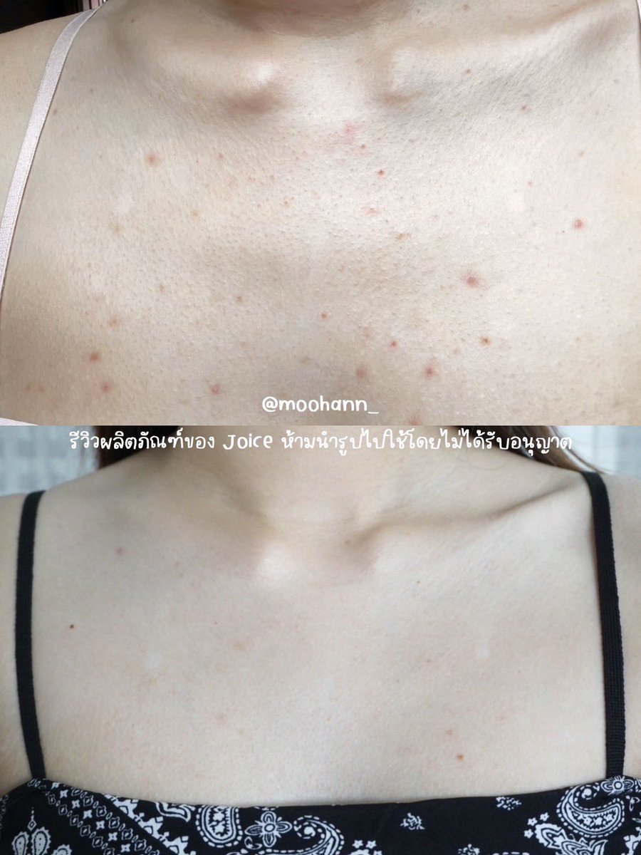 หมูหัน ʕ•ᴥ• ʔ tweet media