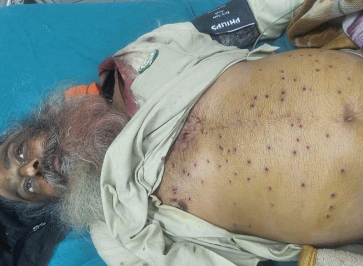 Mann_Sandhu02's tweet photo. Tear gas was used in "Shantmayi Protest" &amp; bullets were fired indiscriminately, vehicles were damaged, border-like arrangements were made to block the roads &amp; our Naujwan Veer was shot dead.

But still "Modi hai to Mumkin hai".
#farmersprotests2024 
#FarmerProtestInDelhi https://t.co/jdtCjFYyKe