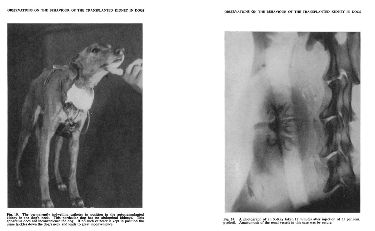 Autotransplantation rénale expérimentale en jugulo-carotidien chez le chien par Dempster et al. en 1950. Stomie urinaire dans le cou.