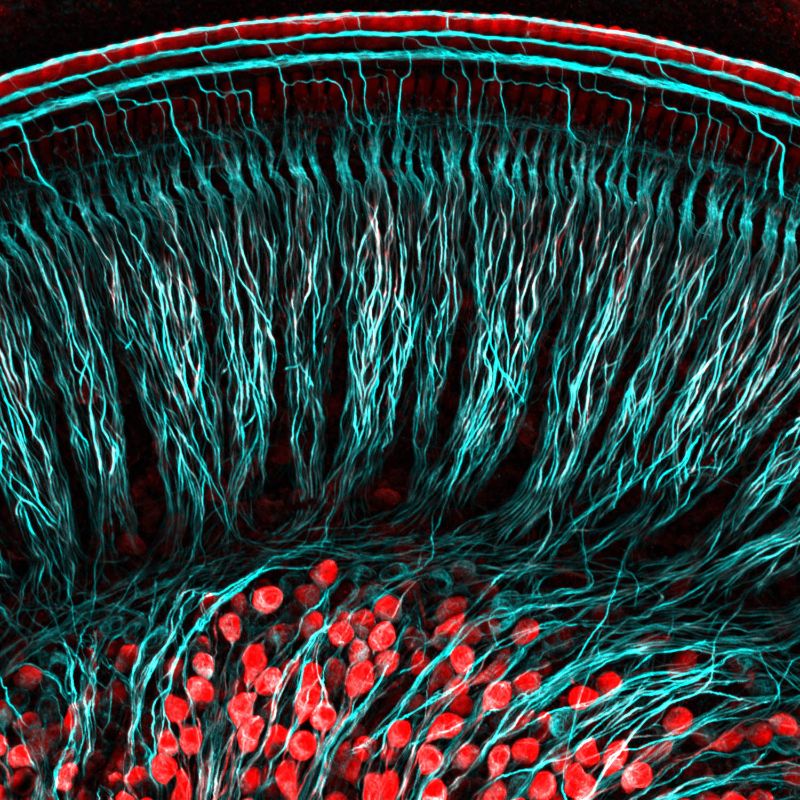 harvardbrainsci's tweet photo. Congratulations to our Beauty of the Brain Image Contest Winners!
@Katelyn_Comeau, Lisa Goodrich Lab
Molly Healey, @AlSerranoPozo Lab
@Wardiya_A_S &amp; @FedeGasparoli,  @Sahin_m Lab
David Zimmerman, Ben de Bivort Lab+ Aravi Samuel Lab
Sampath Vemula, @WhitmanLab https://t.co/jflS4VMYRC