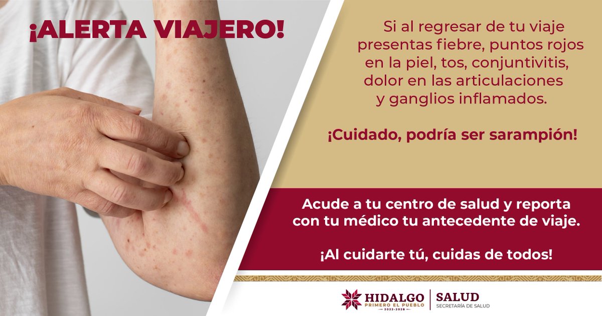 DeTlanalapa's tweet photo. Cuidado con el sarampión, cuídate! #PrimeroTuSalud https://t.co/G3FfJ28jeA