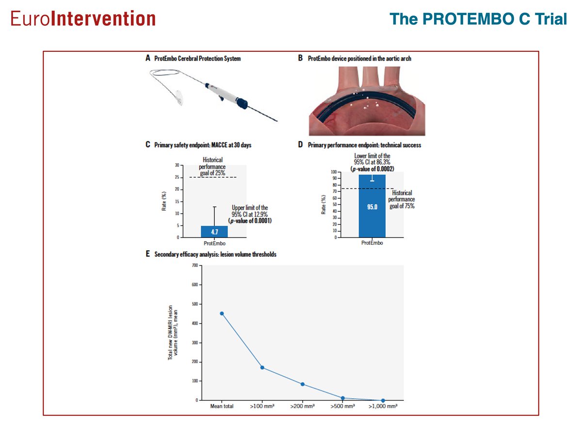 The PROTEMBO C Trial demonstrated the ProtEmbo cerebral embolic protection (CEP) system's safety and effectiveness in patients undergoing transcatheter aortic valve implantation (TAVI), achieving low rates of major adverse cardiac and cerebrovascular events (4.7%) and high