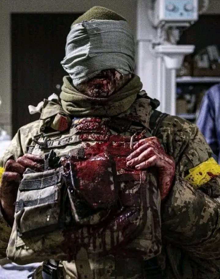Irina61032137's tweet photo. ЦЕ НЕ КАДР ІЗ ЧЕРГОВОГО БОЙОВИКА.
ЦЯ СВІТЛИНА - РЕАЛЬНІСТЬ ВІЙНИ.
Цей хлопець - уособлення України, яка вже пролила так багато власної крові.
А Бахмут - символ незламності та стійкості усього українського народу.
Перемога обов'язково буде, але дорогою ціною. Пам'ятайте про це. https://t.co/u4ZnvrXyTS