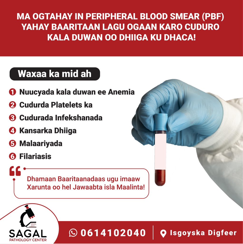 CenterSagal's tweet photo. 𝐁𝐚𝐚𝐫𝐢𝐭𝐚𝐚𝐧𝐚𝐝𝐚 𝐗𝐚𝐫𝐮𝐧𝐭𝐚 #sagal_pathology_center 

Nagala soo xiriir 📞 0614102040

📍 𝐈𝐬𝐠𝐨𝐲𝐬𝐤𝐚 𝐃𝐢𝐠𝐟𝐞𝐞𝐫

https://t.co/p7dLNk7zES https://t.co/58BeNjBEd7