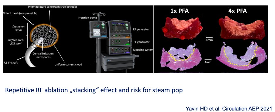 Julian Chun (@jongichun) on Twitter photo <a href="/Phiso_de/">Philipp Sommer</a> <a href="/BA_Mulder/">Bart Mulder</a> <a href="/EHRAPresident/">EHRAPresident</a> I feel PFA has big potential in VT Ablation #EHRAchat <a href="/Phiso_de/">Philipp Sommer</a> <a href="/BA_Mulder/">Bart Mulder</a> <a href="/EHRAPresident/">EHRAPresident</a> I feel PFA has big potential in VT Ablation #EHRAchat