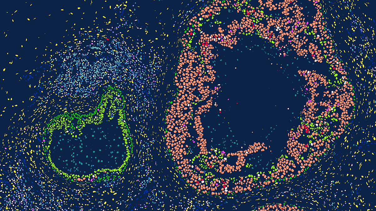 How do you analyse spatial transcriptomics?
python, R, TissUmap, QuPath, commercial software? Asking for a friend #microscopy #imageanalysis #spatial #transcriptomics