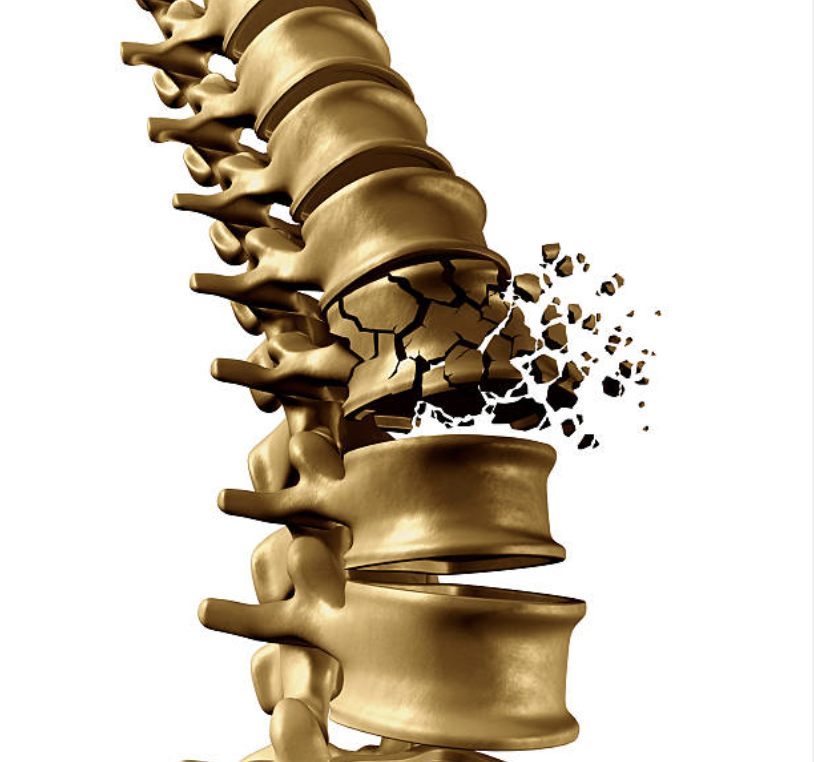 jerryteixeira's tweet photo. If you're a man or woman over 40

You're at increased risk of osteoporosis AND a potential life-altering, catastrophic injury 

Here are 5 things you can do to protect yourself: https://t.co/gxaoATt285