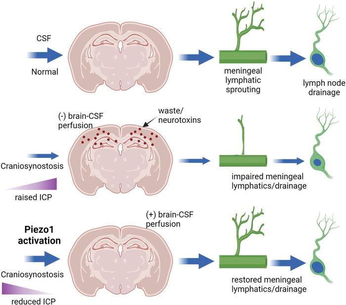 Journal of Clinical Investigation (@jclinicalinvest) on Twitter photo Piezo1 agonist restores meningeal lymphatic vessels, drainage, and brain-CSF perfusion in craniosynostosis and aged mice: buff.ly/48qnvbV
<a href="/tischfield/">Max Tischfield</a> <a href="/Rutgers_NJMS/">Rutgers New Jersey Medical School</a>
#Neuroscience #VascularBiology Piezo1 agonist restores meningeal lymphatic vessels, drainage, and brain-CSF perfusion in craniosynostosis and aged mice: buff.ly/48qnvbV
<a href="/tischfield/">Max Tischfield</a> <a href="/Rutgers_NJMS/">Rutgers New Jersey Medical School</a>
#Neuroscience #VascularBiology