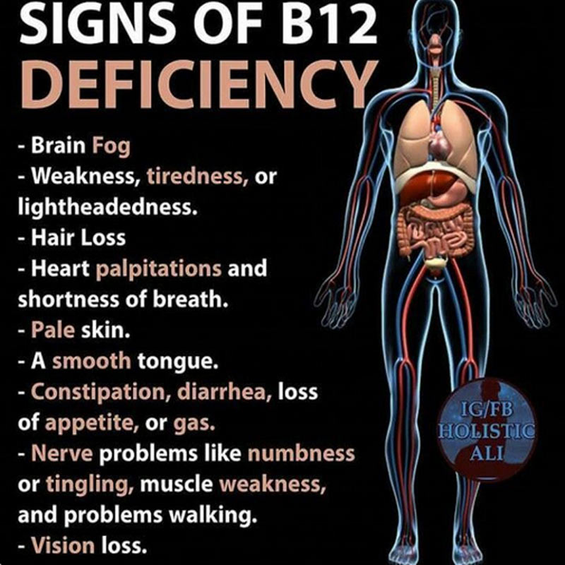 OrganicLiveFood's tweet photo. Vitamin B12 deficiency is common among elderly people, vegans and people with a condition called pernicious anemia (inability of B12 from being absorbed in the body) which can cause this type of nerve damage

https://t.co/ExPyBsJpZE