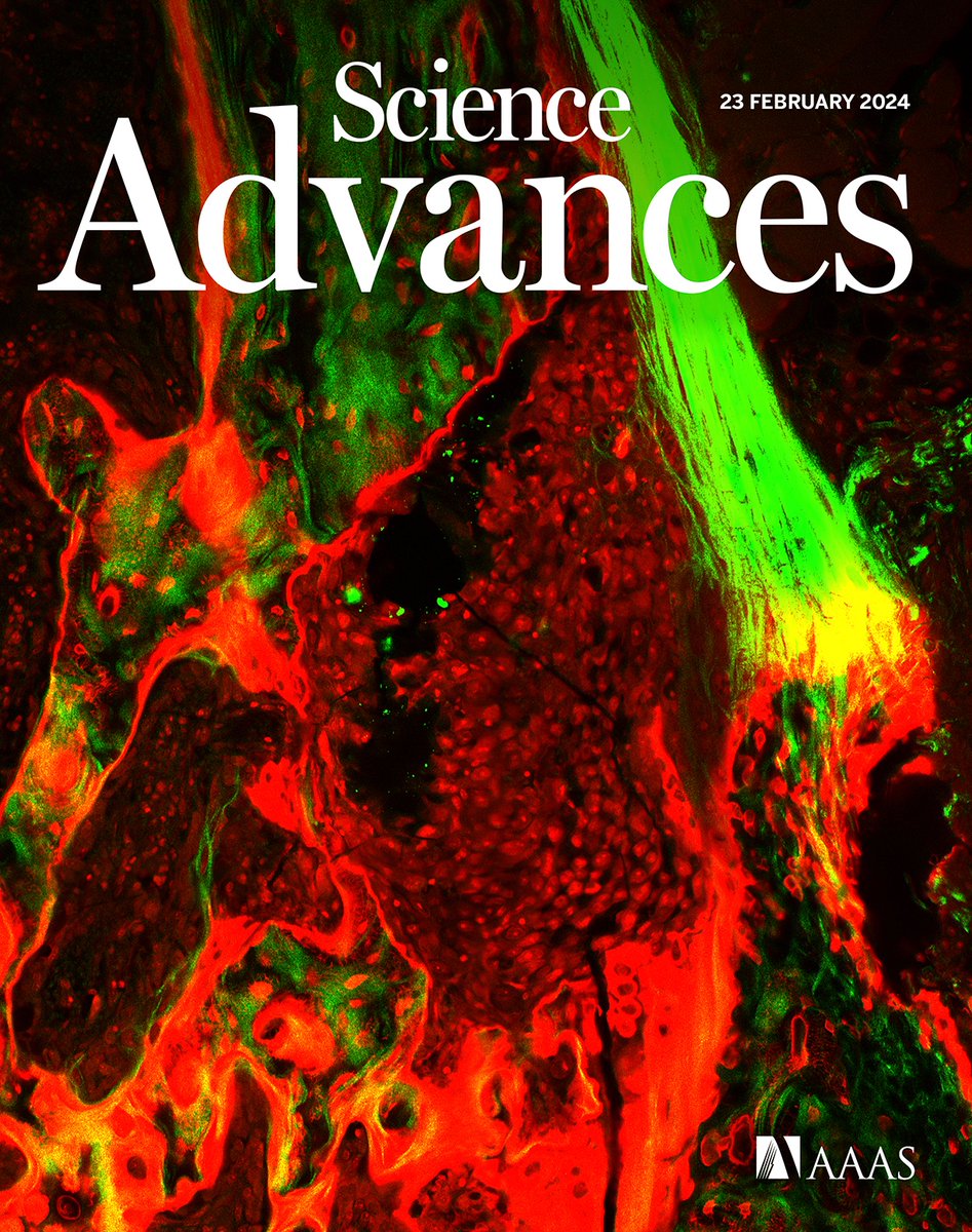 amaia_cipitria's tweet image. Excited to share work by @SarahAEYoung featuring  #cover @ScienceAdvances, showing with #lightsheet and #microCT cancer cells homing to all bone sites, yet metastasis initiating in high remodeling sites. @MpiciPotsdam @biogipuzkoa @Ikerbasque @dfg_public 👉bit.ly/3UQXvTW