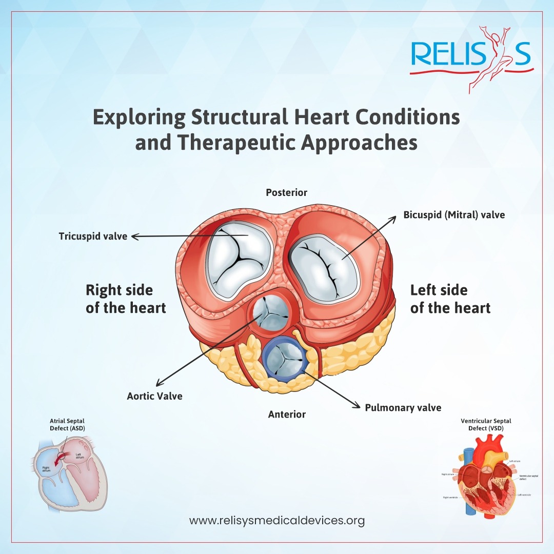 #RELISYS is committed to introduce latest #advancements in #technology for the overall #wellbeing of the #patients and improving #outcomes Read the full blog here: relisysmedicaldevices.org/exploring-stru… #heartvalveawarenessday #hearthealthawareness #structuralheart #cardiology @relisysmedical