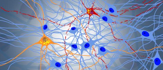 University of Zurich (@uzh_en) on Twitter photo How to counteract fatal neurodegeneration? Researchers at UZH discover misbehaving protein responsible for destroying neurons – a promising therapeutic target for treating ALS and FTD diseases: news.uzh.ch/en/articles/me…
@PolymenidouLab <a href="/UZH_Science/">UZH Science</a> How to counteract fatal neurodegeneration? Researchers at UZH discover misbehaving protein responsible for destroying neurons – a promising therapeutic target for treating ALS and FTD diseases: news.uzh.ch/en/articles/me…
@PolymenidouLab <a href="/UZH_Science/">UZH Science</a>