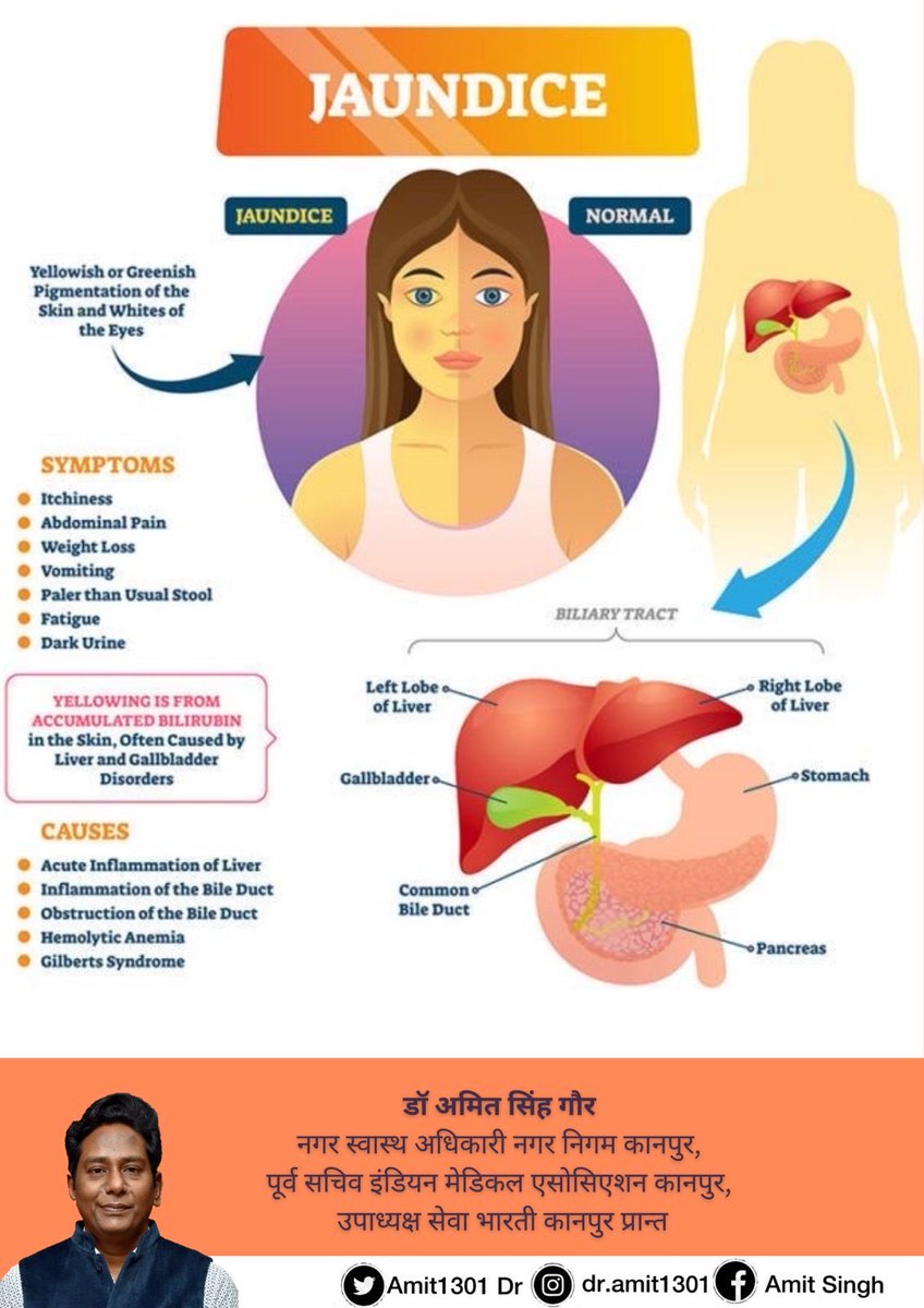 Amit1301Dr's tweet photo. #healthtips #kanpur https://t.co/Hj0cWCY970