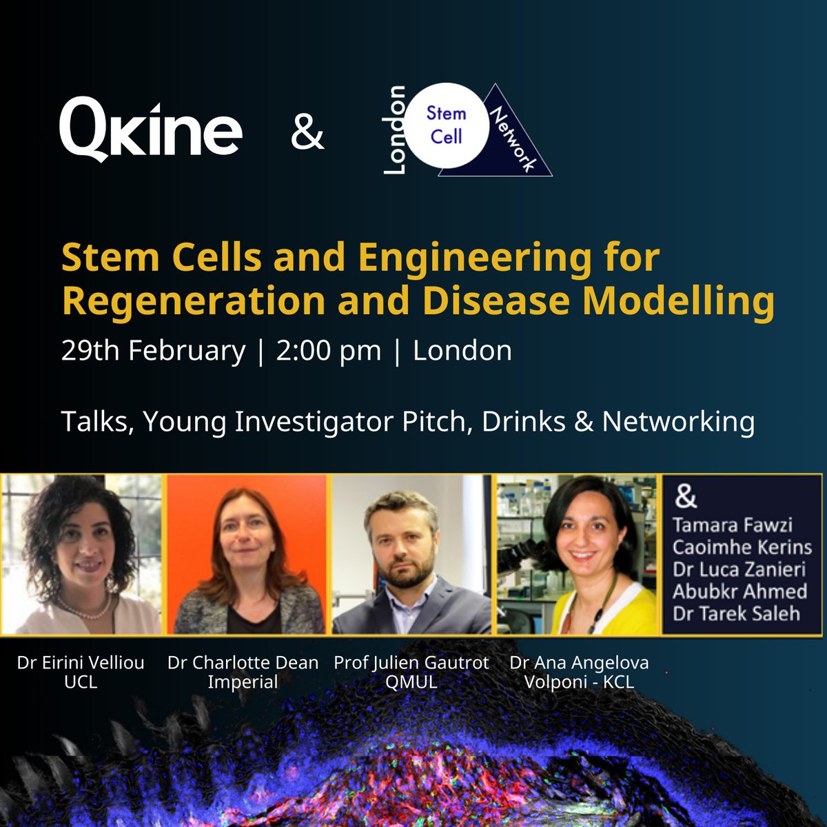 Don't miss our upcoming workshop with @LSCN_UK! Enter our image competition showcasing your research in Regeneration and Disease Modelling. Register and submit your image here: zurl.co/cXaN #StemCells #Research #Workshop #RegenerativeMedicine #TissueEngineering
