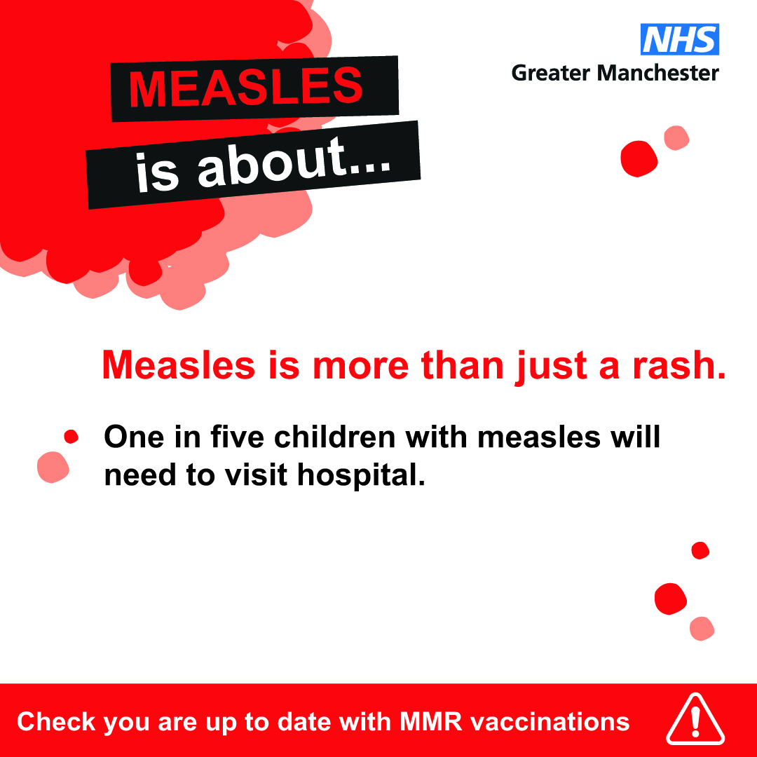 Measles is more than just a rash. It can be very serious, so make sure you’re up to date with MMR vaccinations. Ask your GP about catch up jabs if you need them.
