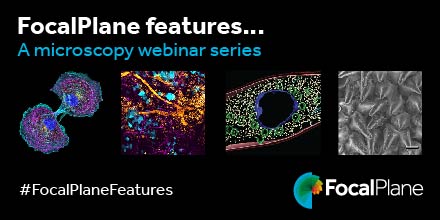 📢Announcing a new series of #FocalPlaneFeatures Our first webinar focusses on outreach projects with talks from Paola Moreno-Roman from @teamfoldscope, Alex Strachan from @EMC_PlymUni and Martin Jones from @TheCrick. For more details and to register: focalplane.biologists.com/2024/02/22/new…