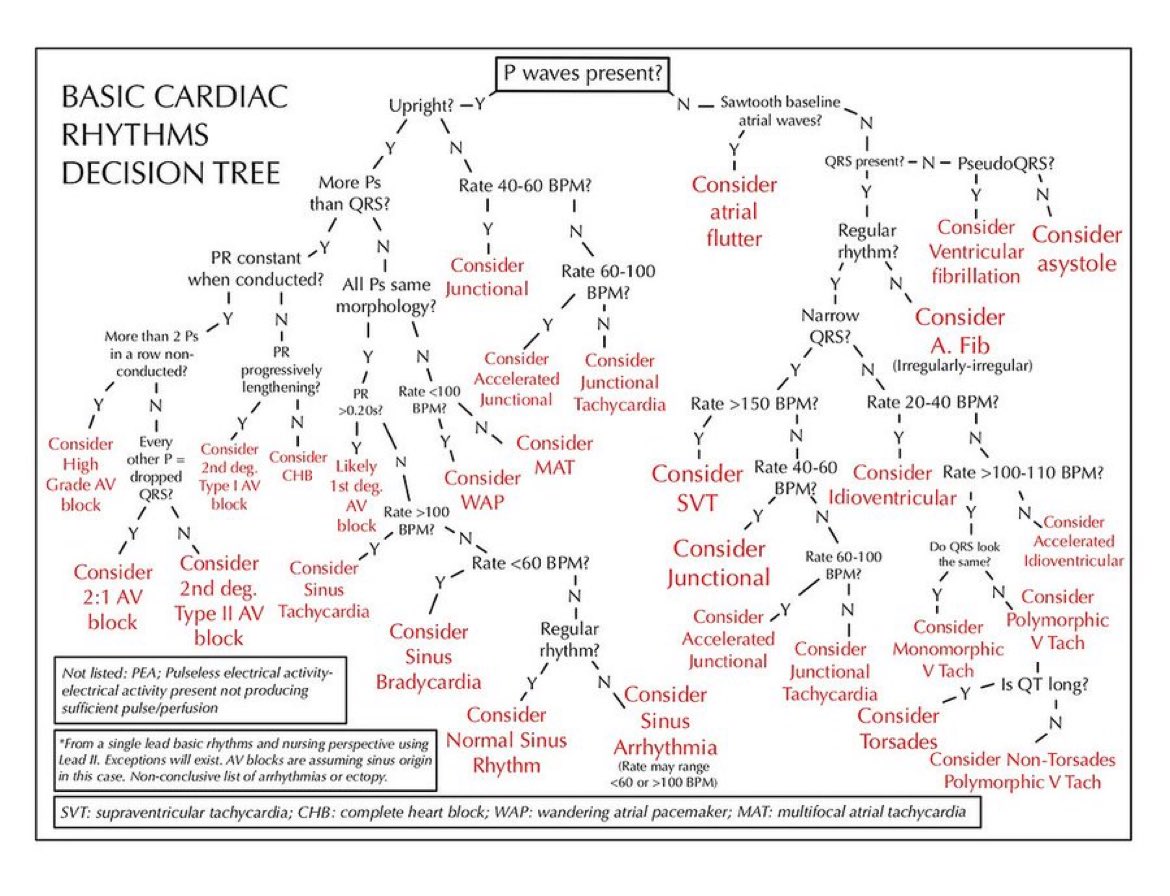 Basics of EKG Decision tree