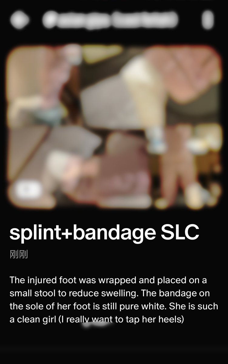asiangips's tweet image. update
Chinese way of SLC
splint+bandage
👉🏻 patreon.com/user?u=95272605

#castleg #longlegcast #castplaster #gips #fibercast #gipsbein #footfetish #yeso #castgirl #toes #llc #fulllegcast #gesso #brokenankle #brokenleg #brokenarm #feet
#castedleg #castedgirl #castedarm #wheelchair