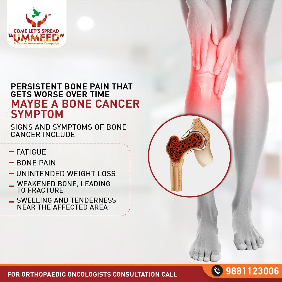Bone pain could be a sign of more serious issues. Stay informed and vigilant about bone cancer symptoms.

To Book an Onco Orthopaedic consultation, call us at 9881123006

#ABMH #ummeed #adityabirlamemoriahospital #orthopedic #sportsinjury #bonecancer #hospital