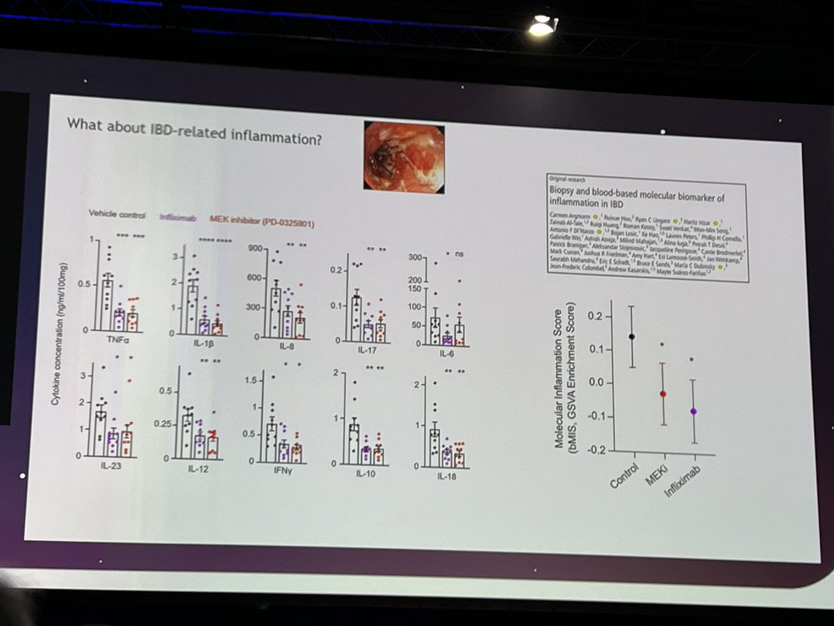 Amazing talk from @Dr_James_Lee at #ECCO24 on the work his lab have done related to ETS2 in #IBD and its potential for therapeutic advances Preprint on Biorxiv: biorxiv.org/content/10.110…