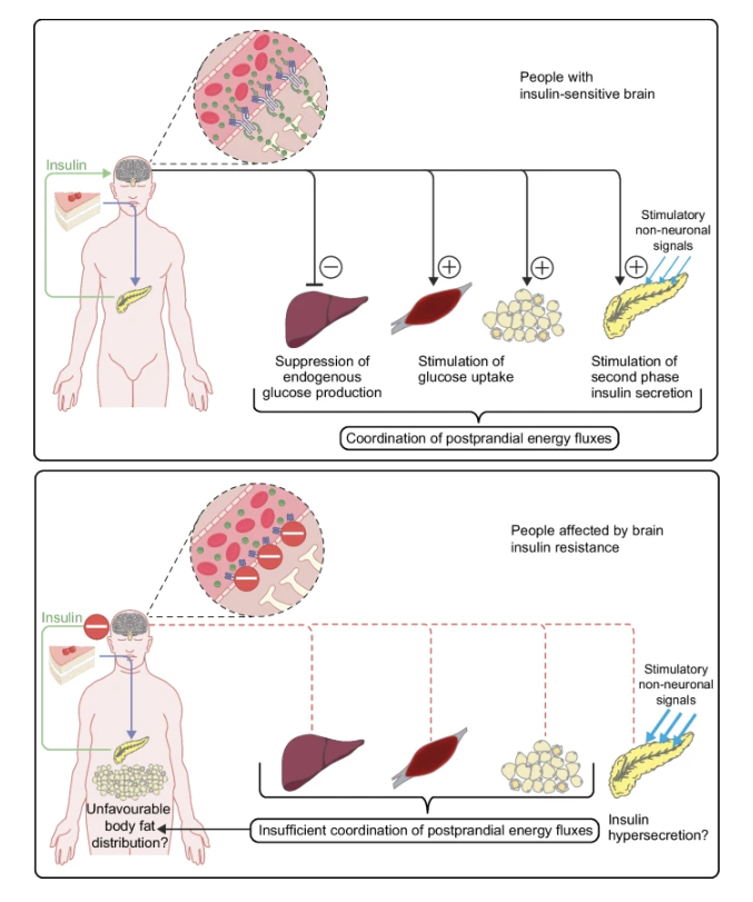 Diabetologia (@diabetologiajnl) on Twitter photo A review by <a href="/MaHeUlm/">Martin Heni</a> discusses the impact of brain insulin resistance on whole-body metabolism, body fat distribution and cognition, and its role in high-risk phenotypes and potential therapeutic options <a href="/uni_ulm/">Universität Ulm</a> #Minkowski Prize tinyurl.com/54h997d8 🔓 A review by <a href="/MaHeUlm/">Martin Heni</a> discusses the impact of brain insulin resistance on whole-body metabolism, body fat distribution and cognition, and its role in high-risk phenotypes and potential therapeutic options <a href="/uni_ulm/">Universität Ulm</a> #Minkowski Prize tinyurl.com/54h997d8 🔓