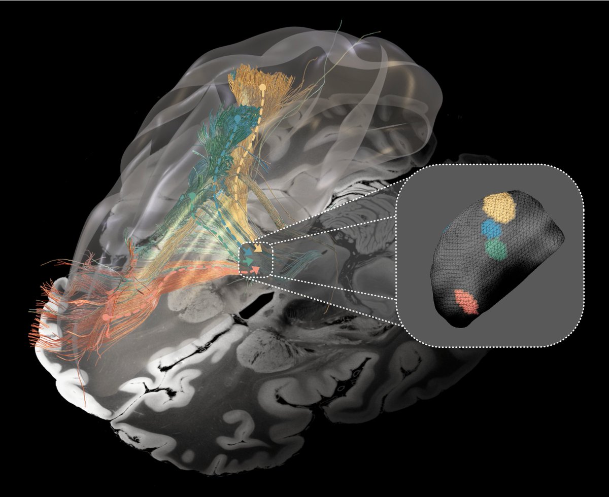 Einem vermeintlichen Paradoxon der #Neurowissenschaft auf der Spur: Forschende unter Leitung von #CharitéBerlin und @BrighamWomens  zeigen gestörte Netzwerke im Gehirn, die zu Parkinson, Dystonie, Zwangsstörung und Tourette führen – jetzt @NatureNeuro.👉charite.de/service/presse…