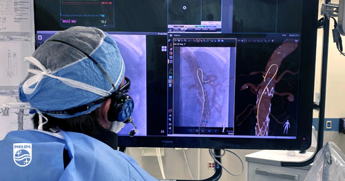 PhilipsPR's tweet photo. .@Philips LumiGuide is – the world’s first “3D human GPS powered by light” – is made commercially available to specialized hospitals in Europe and the US. LumiGuide paves the way for radiation-free minimally-invasive surgery. Read more: https://t.co/8O2lSDu5tq https://t.co/DfiEVXOVs4