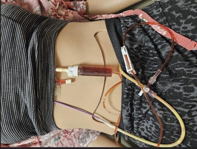HealthySim's tweet photo. New Article: "How to Make an Accessible and Wearable Medi-Port for Simulation" #Wearable #ClinicalSimulation #TaskTrainer - https://t.co/n78umRmCR7 https://t.co/j5iX5K9mk1