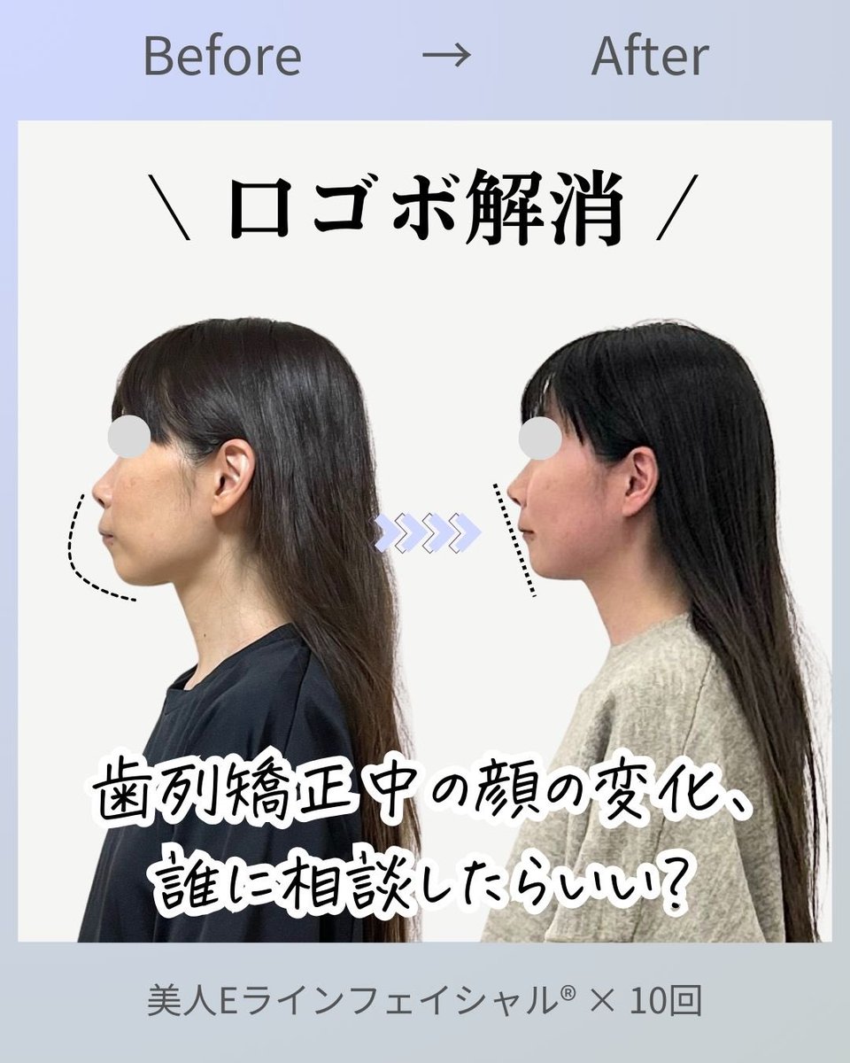 【中古】 歯が悪いと顔も頭も悪くなる 今川ちか@プレゼント企画中！整形レベルの小顔スクール on X