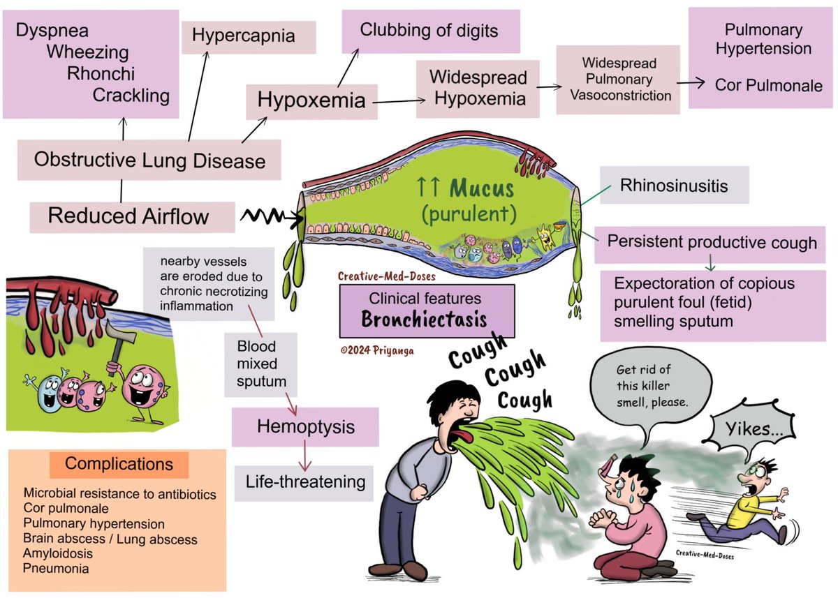 Creativemeddose's tweet image. Bronchiectasis
#MedEd 
#FOAMed 
#Lungdisease

Please read full article at website 
….
….
🥰😍😎