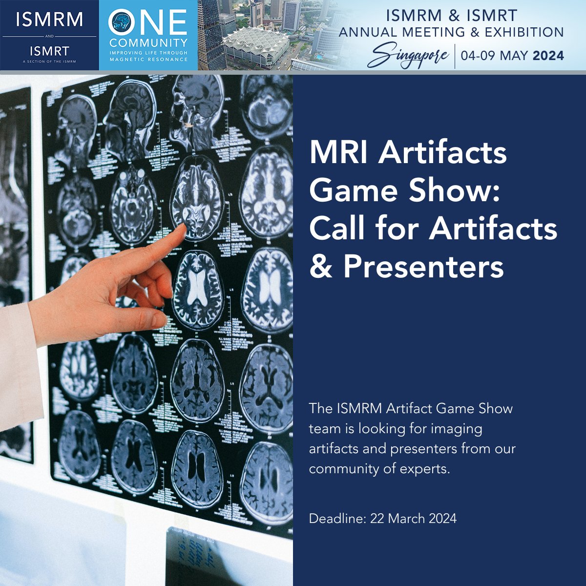 Be a part of the MRI Artifacts Game Show at the ISMRM &amp; ISMRT Annual Meeting &amp; Exhibition! Contribute to the show either in-person or virtually, simply by providing an artifact to us.

Learn more: ow.ly/luhr50QGuWy
#ISMRM #ISMRT #MagneticResonance #MRI #MagneticResonance