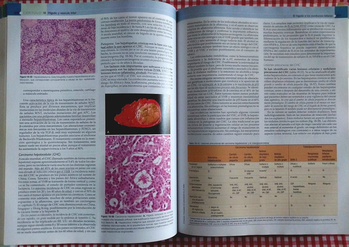 Vendo Robbins de Anatomía Patológica‼️ 
-Libro original 9na edición
-Excelente estado
-Forrado con contac
-Resaltado en algunas páginas
Precio: 500.000 gs
Interesados al 0982 735 570
Se agradece RT 🙌