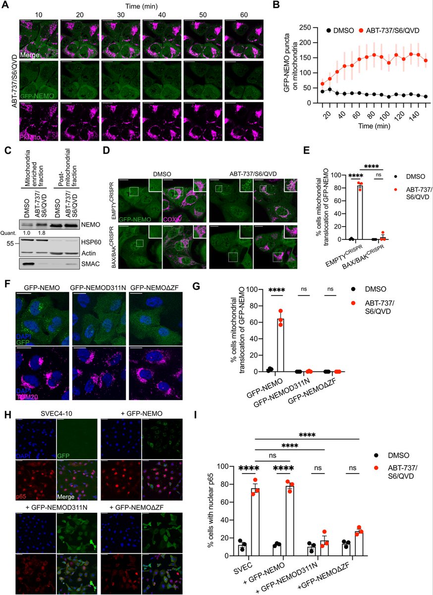 Madam_Mito's tweet photo. Mitochondrial outer membrane integrity regulates a ubiquitin-dependent and NF-κB-mediated inflammatory response.

https://t.co/fibLZVtIlG https://t.co/QX8QAD4c7U